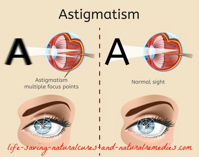 A Home Remedy for Astigmatism That Works Like a Charm!